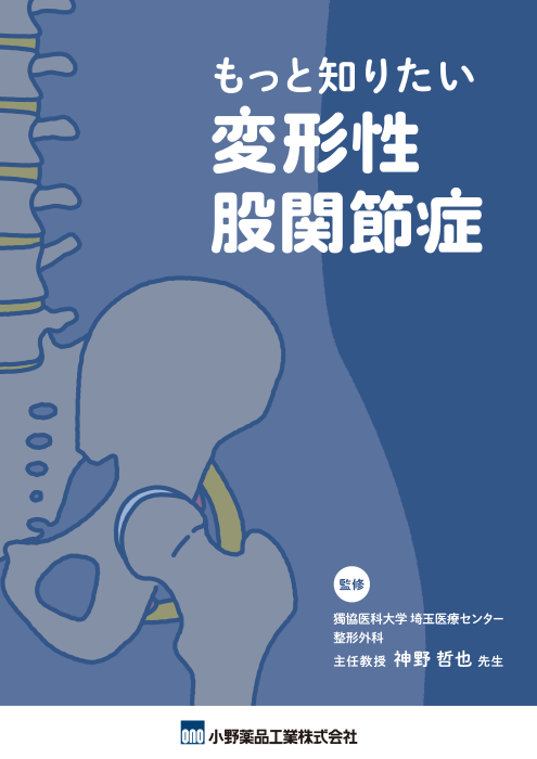 もっと知りたい 変形性股関節症